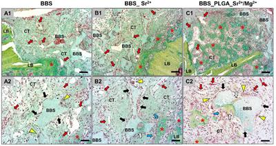 Biphasic bone substitutes coated with PLGA incorporating therapeutic ions Sr2+ and Mg2+: cytotoxicity cascade and in vivo response of immune and bone regeneration